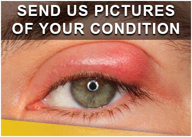 Send Picture of Your Condition